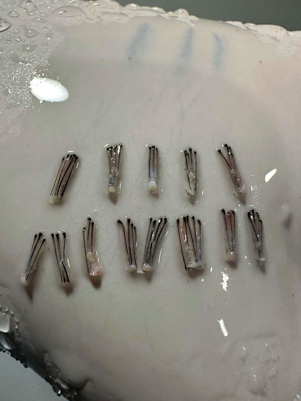 We always choose the highest quality hair follicles