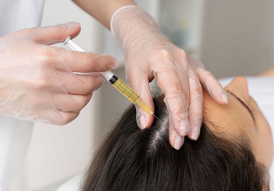 PRP Hair Treatment